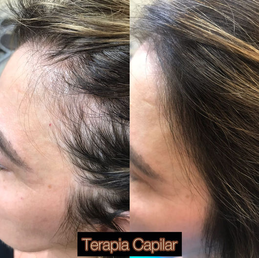 Antes e depois de tratamento capilar