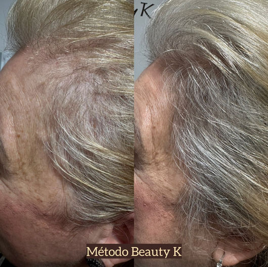 Antes e depois de tratamento capilar