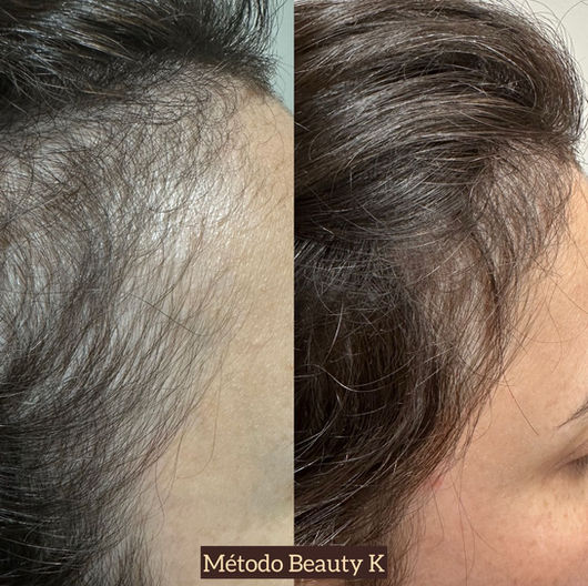 Antes e depois de tratamento capilar
