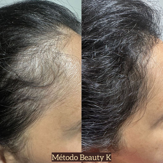 Antes e depois de tratamento capilar